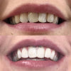 Whitening Bain de Bouche iD+