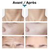 Appareil soin visage EMS Diamond stimulation musculaire