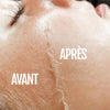 Appareil soin visage exfoliant Diamond peau lumineuse
