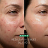 Masque LED pour une peau plus eclatante et revitalisee