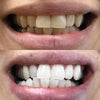 Blanchiment dentaire PAP+ Strips pour blanchir les dents