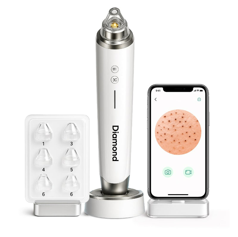 ClearCam - Extracteur de points noirs