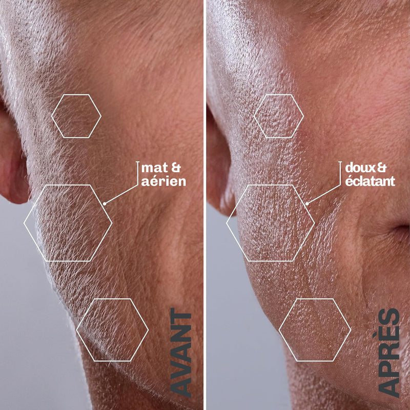 SILKYFLASH+ Dermaplaning Sonique Visage