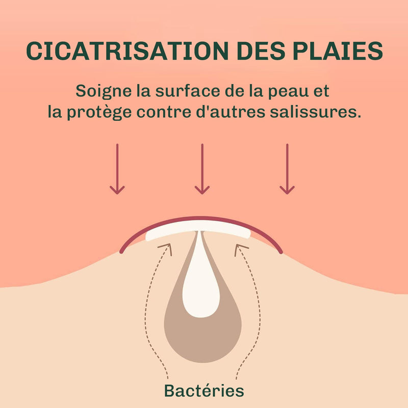 Patchs anti-boutons invisibles