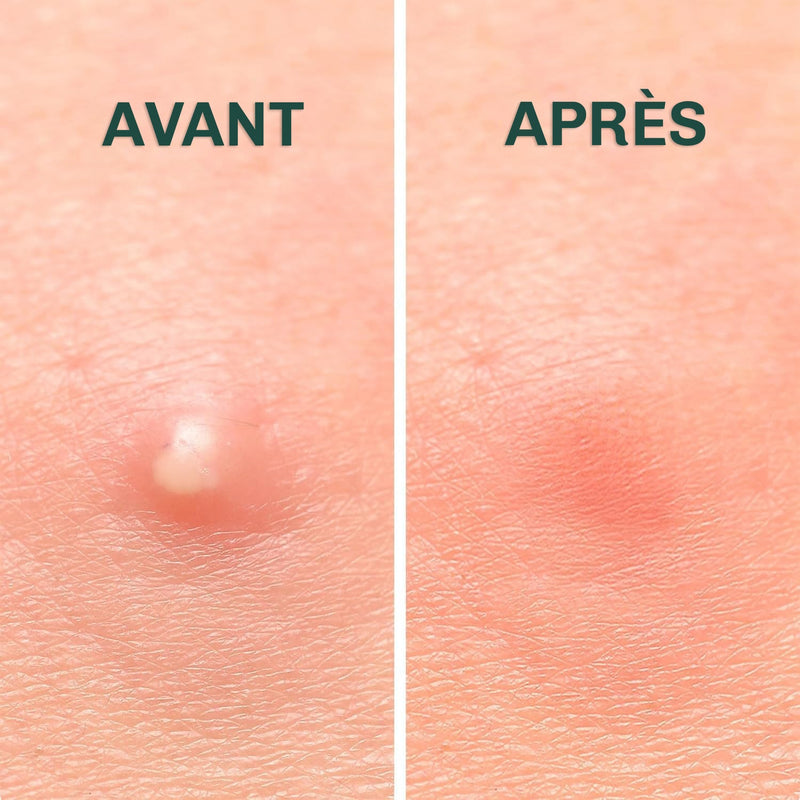 Patchs anti-boutons invisibles