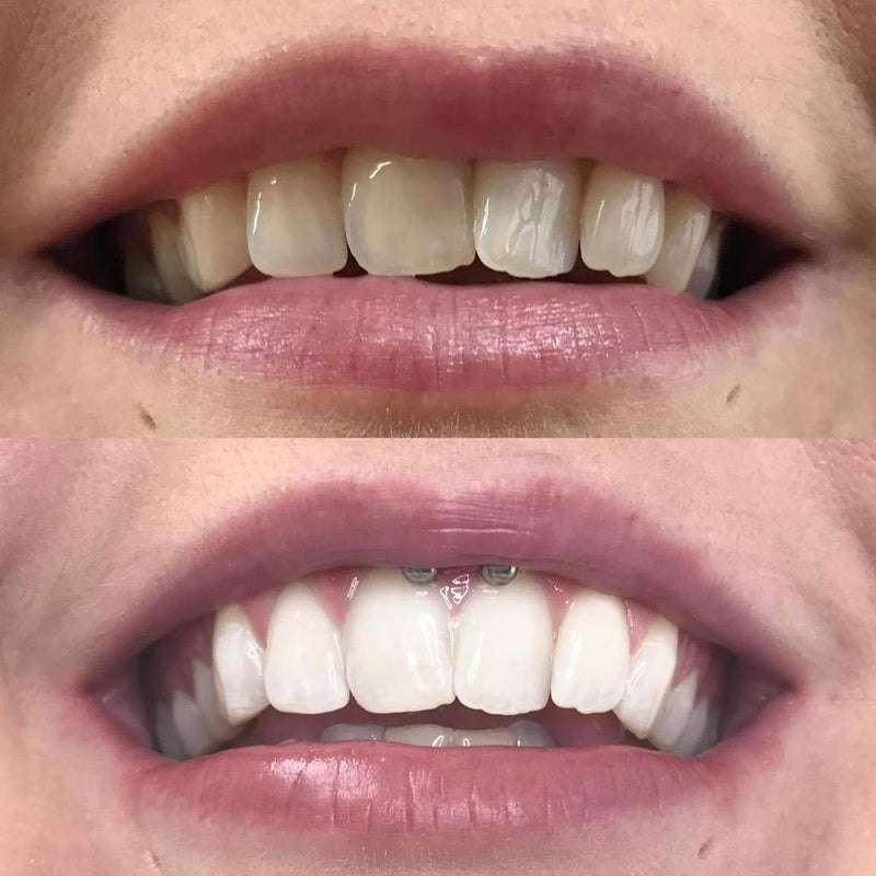 Whitening Bain de Bouche iD+