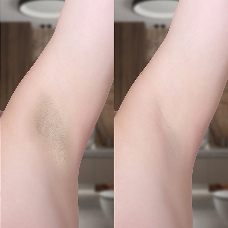 Appareil epilation Diamond jambes bras visage