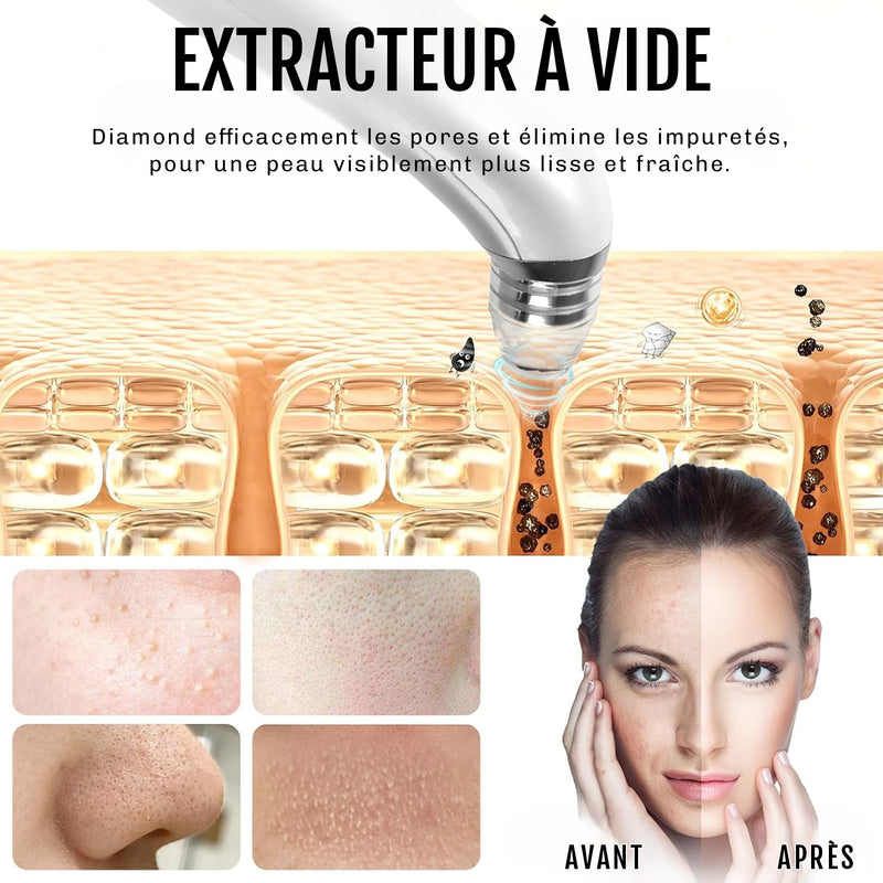 Appareil exfoliation visage Diamond peau lisse