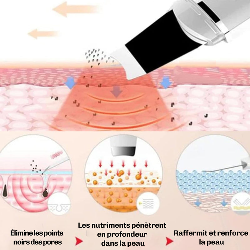 Appareil peeling peau maison DermaGlow 5 Diamond exfoliation douce