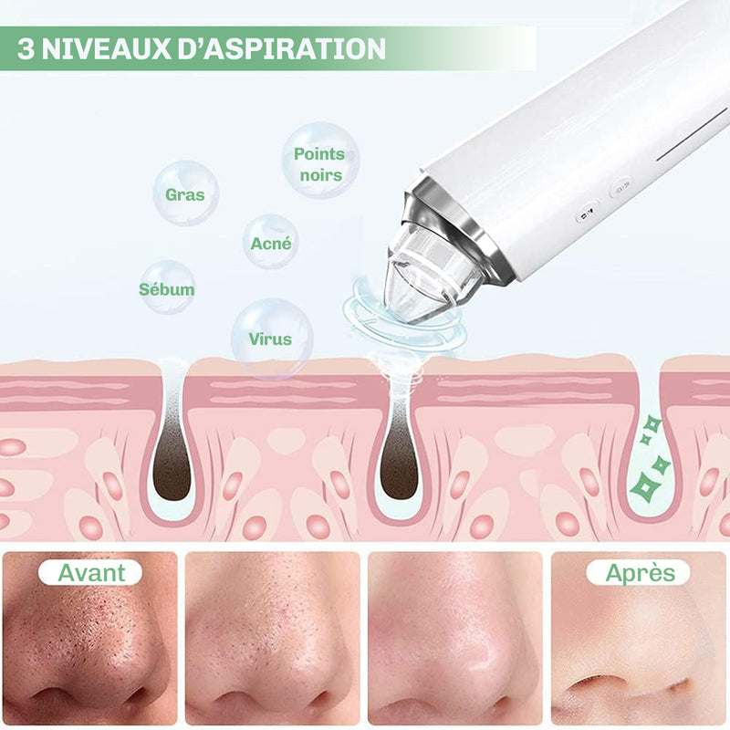 Appareil points noirs camera HD ClearCam Diamond pores peau