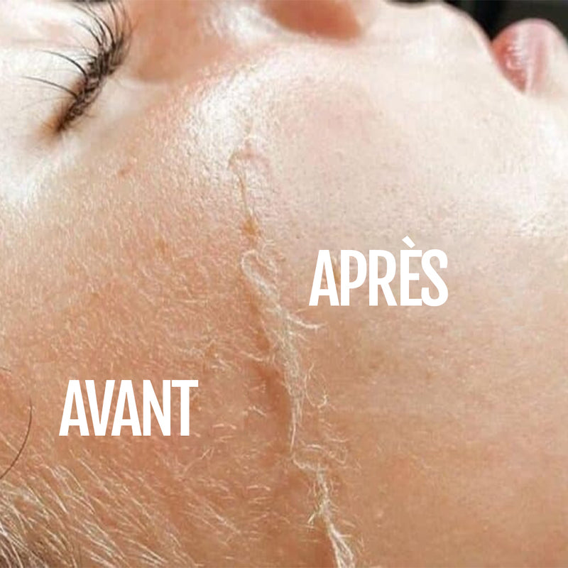 Appareil soin visage exfoliant Diamond peau lumineuse
