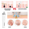 Aspirateur pores visage ClearCam Diamond purification peau
