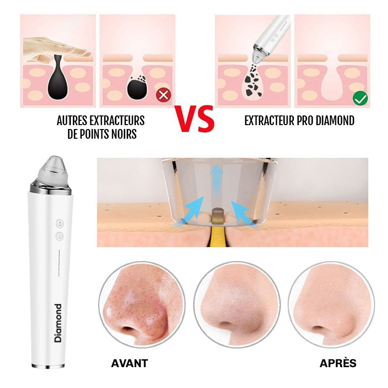 Aspirateur pores visage ClearCam Diamond purification peau