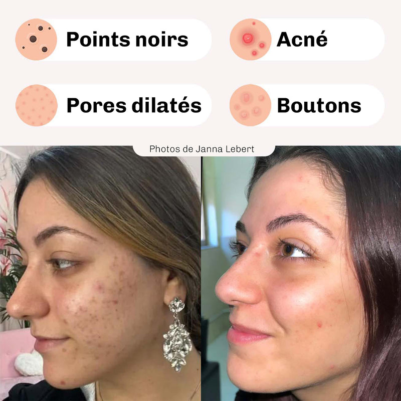 Creme nettoyage pores Diamond peau rafraichie
