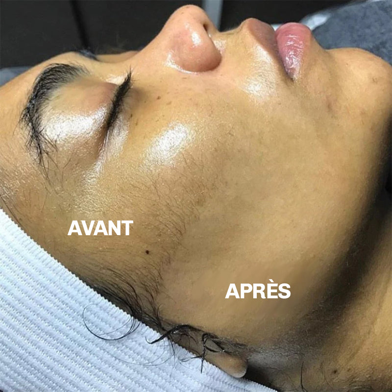 Exfoliation visage precision Diamond peau uniforme