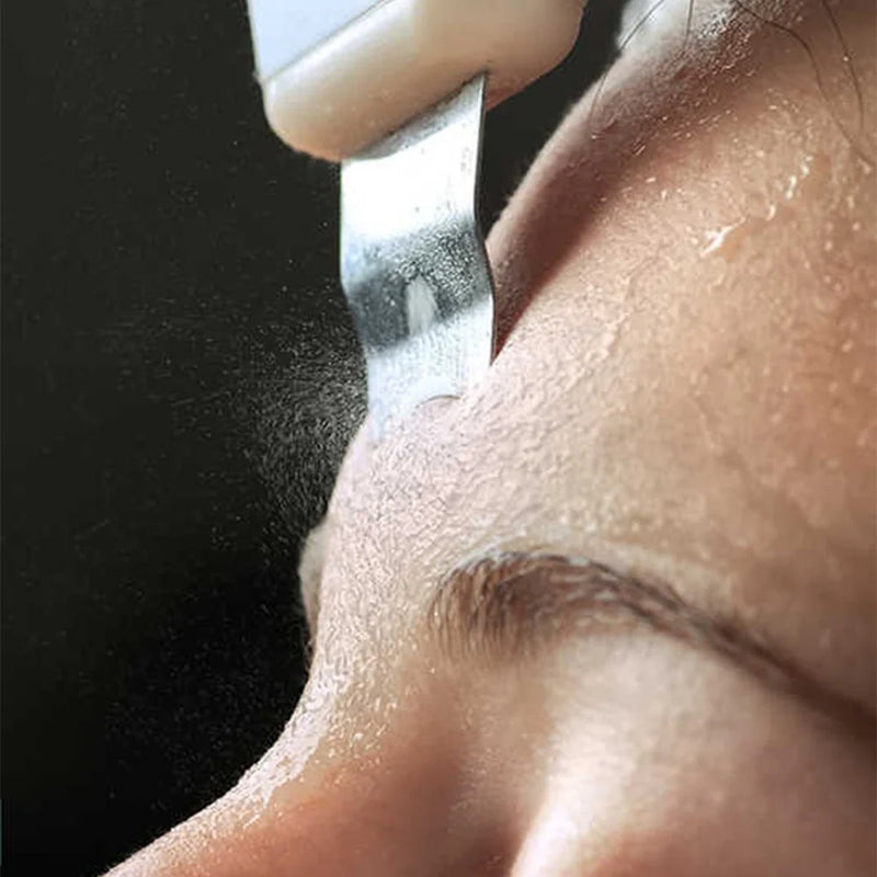 DermaGlow 5 - Ultrasons Peeling Visage