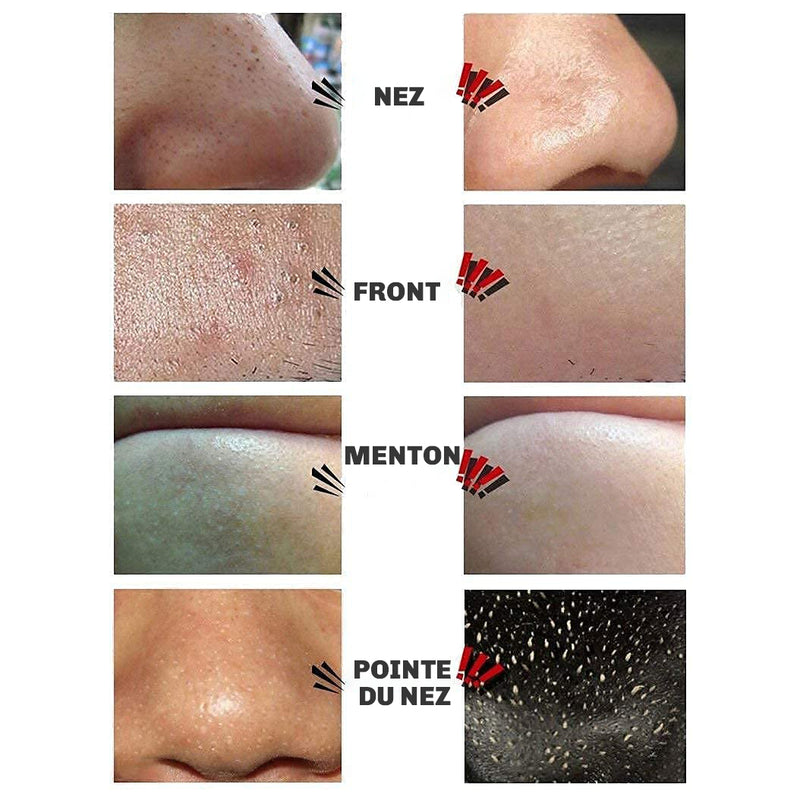 Masque peel off visage Diamond extraction impuretes