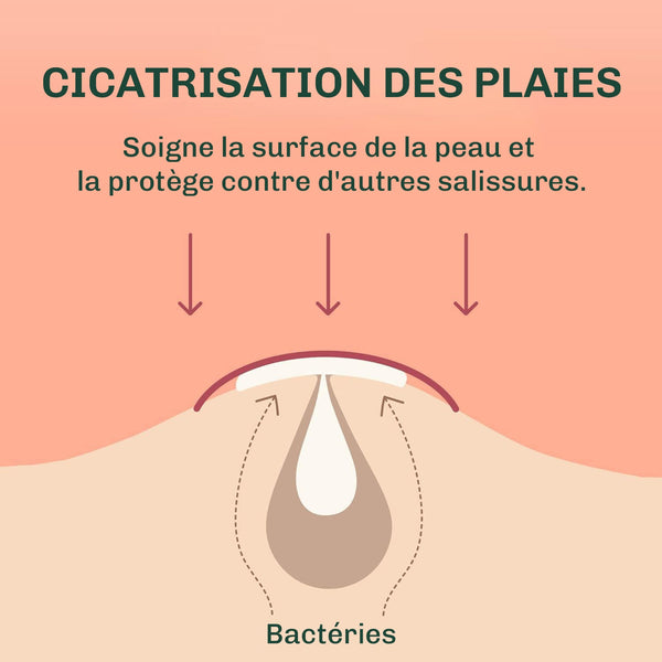 N°1 – Patch anti boutons & Ultra-efficace patch acné peau sensible ...