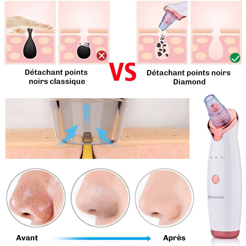 SkinClear 3 Aspirateur à Points Noirs