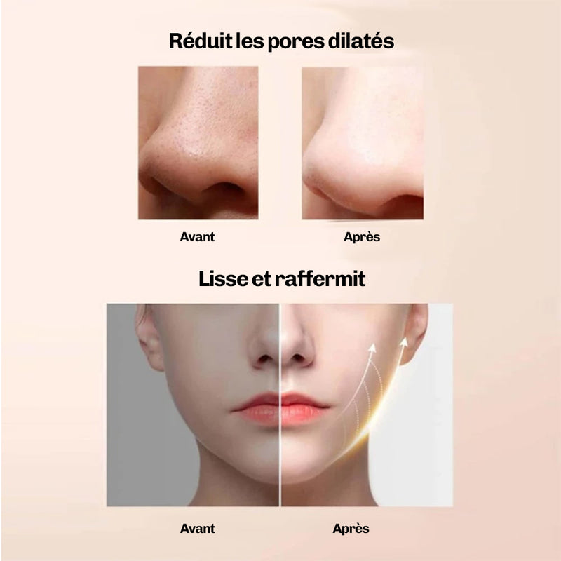 DermaGlow 5 - Ultrasons Peeling Visage